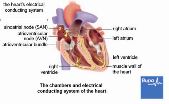 Arrhythmia_Eng