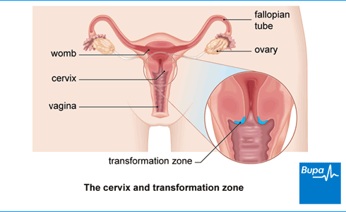 Colposcopy-Eng